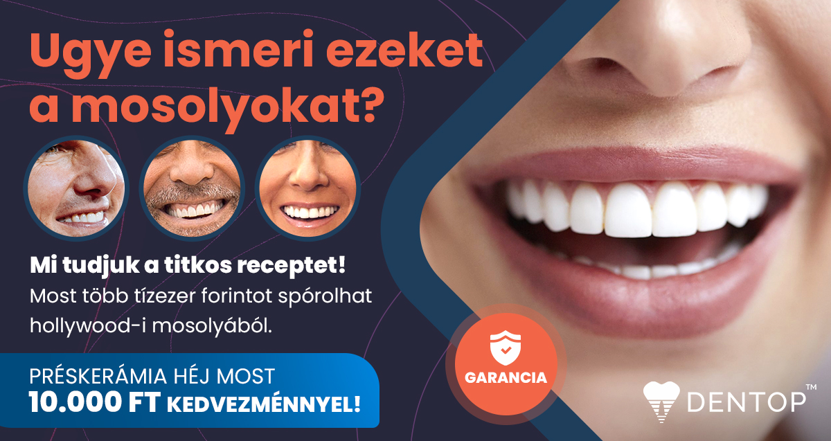Foghej Tapasztalatok