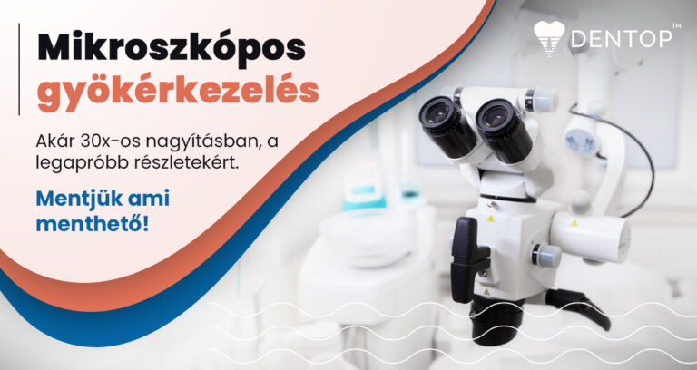 5f0caed28099f-large mikroszkópos gyökérkezelés