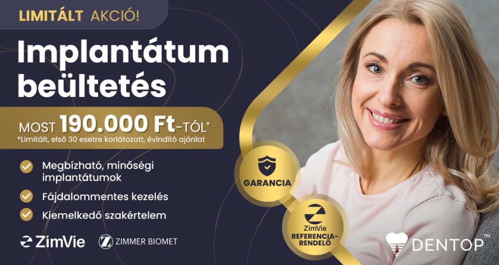 dentop-implantatum-3-akcio