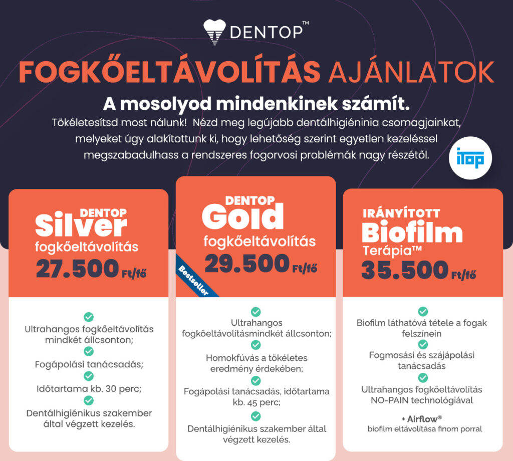 Dentop kedvezményes fogkőeltávolítás csomagok