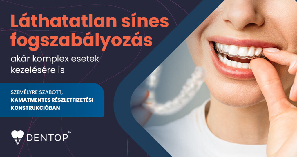Láthatatlan sínes fogszabályozó ajánlat