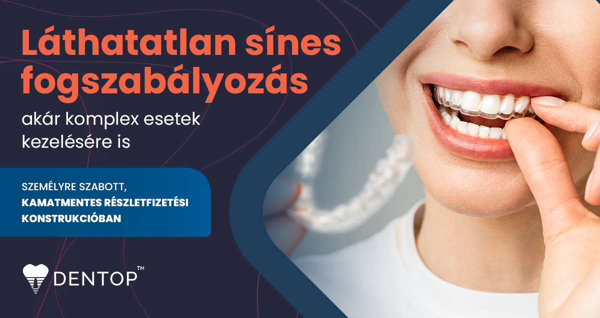 Láthatatlan sínes fogszabályozó ajánlat