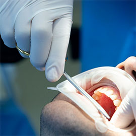 Oral Surgery