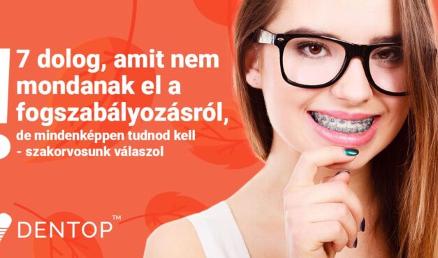 7 dolog, amit nem mondanak el a fogszabályozásról, de mindenképpen tudnod kell, szakorvosunk válaszol!