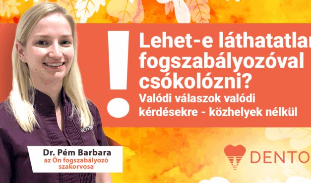 Lehet-e láthatatlan fogszabályozóval csókolózni? Valódi válaszok valódi kérdésekre - közhelyek nélkül